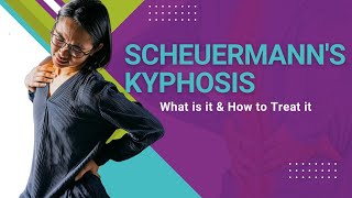 Scheuermanns Kyphosis  What is it amp How to Treat it [upl. by Knox]