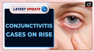 Conjunctivitis Cases on Rise  Latest update  Drishti IAS English [upl. by Ternan714]