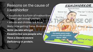 An informational video for Kwashiorkor [upl. by Florrie535]