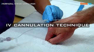 Tips and tricks for IV cannulation [upl. by Eyot108]