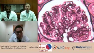 Web Episode 002  Renal Pathology Teaching Series Dr Gaut and Dr Rajan [upl. by Peta]