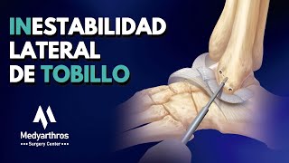 Inestabilidad Lateral de Tobillo [upl. by Eceryt169]