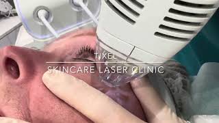 TIXEL  SKINCARE LASER CLINIC  POINTCOOK  MELBOURNE [upl. by Vidovic995]