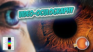 Video oculography Your EYEBALLS 👁️👁️💉😳💊🔊💯✅ [upl. by Rexanna]