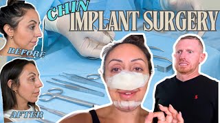 Chin Implant and Deviated Septum Surgery Results My Honest Review [upl. by Ahsenrad]