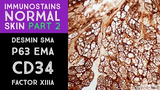 Immunohistochemistry in Normal Skin p63 EMA desmin SMA CD34 Factor XIIIa [upl. by Jandy]