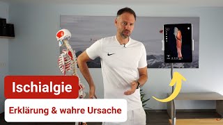 Ischialgie  Der wahre Grund für Deine Ischiasschmerzen ❌ [upl. by Fisch]