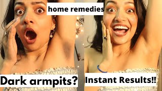 Home remedies to whiten your underarms in just one go  Yashasvi Rajpoot [upl. by Riana]