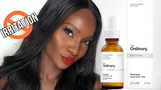 THE ORDINARY MANDELIC ACID  HA  HOW TO USE  REVIEW [upl. by Ronoel]