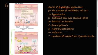 53  Thrombosis Virchows triad Endothelial Injury [upl. by Walcott]