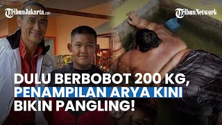 Bikin Pangling Netizen Inilah Penampilan Terbaru Arya Permana Bocah Obesitas 200 Kg [upl. by Eirameinna]