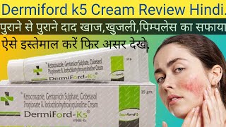 Dermiford K5 Cream Ke Fayde Dermiford K 5 Cream Uses in Hindi [upl. by Oinegue]