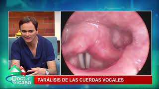 Parálisis de cuerdas vocales [upl. by Enelhtac]