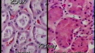 Basic Medical Pathology Morphological Expressions of Cell Injury [upl. by Jilly860]