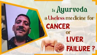 Is Ayurveda a Useless medicine for Chronic Liver Disease [upl. by Ataga]