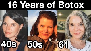 My 16 Year Botox Journey for Preventing Wrinkles  Antiaging Strategies for 40s 50s and 60s [upl. by Nomzaj]