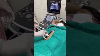 Liver Abscess Aspiration Procedure [upl. by Airottiv]