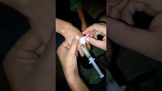 Intravenous injection procedure ll intravenous injection administration ll intravenous injection ll [upl. by Ahsikar]