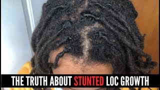 Why Your Locs have STOPPED GROWING  Stunted Hair Growth Color Dyes amp more [upl. by Florry357]