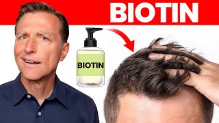 Does Biotin or Biotin Shampoo Really Work for Hair Loss [upl. by Iek]