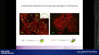 Myelin regeneration and ageing  Robin Franklin [upl. by Hoskinson356]