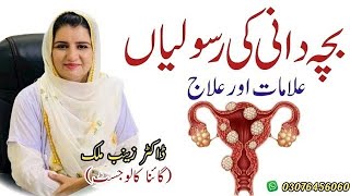 What is Uterine Fibroid in Urdu  Uterine fibroids explained by Dr Zainab Malik [upl. by Adnir]