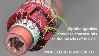 Opioid antidiarrheal medications Loperamide and diphenoxylate [upl. by Ia]