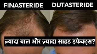 Finasteride vs Dutasteride in hindi  ये बातें कोई नहीं बताएगा [upl. by Campbell966]