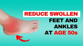 How to Quickly Relieve Swollen Feet and Ankles in Your 50s 6 Effective Treatments [upl. by Togram]