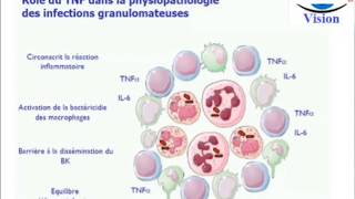 Physiopathologie et Traitement du Psoriasis Biothérapie Spondylarthropathies [upl. by Madora]