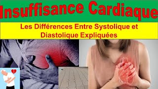 Insuffisance Cardiaque Congestive  Causes Symptômes et Traitements Avancés [upl. by Rebmik]