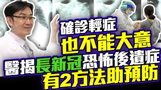 確診輕症也不能大意！ 醫揭「長新冠」恐怖後遺症有2方法助預防｜中時新聞網 [upl. by Vasily3]