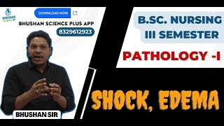 Class 7  Shock  Edema  PathologyI [upl. by Nilyram]