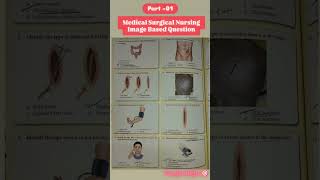 Medical surgical nursing image based questions 🎯 medicalsurgicalnursingNursingNursingofficer [upl. by Ettevy61]