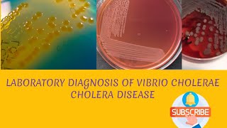 Laboratory diagnosis of Vibrio cholerae in hindi [upl. by Jamil775]