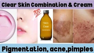 Top 2 Homeopathic medicine for clear Skin Combination amp homemade cream  glowing skin naturally [upl. by Wrdna59]