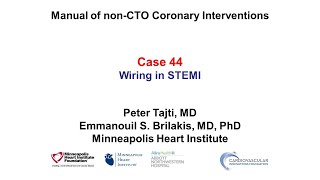 Case 44 PCI Manual  Wiring in STEMI [upl. by Nessi222]