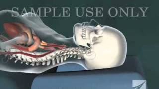 Cervical Chiropractic Adjustment [upl. by Mapel]