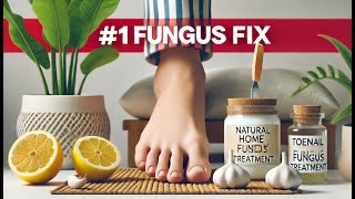 1 Toenail Fungus Treatment 10 MustTry Home Remedies [upl. by Manara]