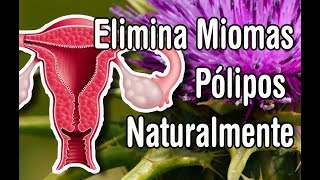 COMO ELIMINAR POLIPOS Y MIOMAS DE MANERA NATURAL [upl. by Adlev]