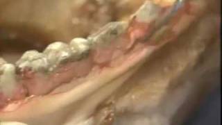 Introductory Periodontal Surgery Techniques Modified Widman Flap [upl. by Ecinhoj]