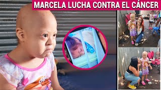 Marcela Lucha contra el cancer y con el síndrome de Down Marce niña de 5 años Conoce su historia😔 [upl. by Modeste]