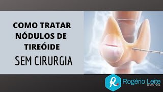 Como Tratar Nódulo De Tireoide Sem Cirurgia Dr Rogério Leite [upl. by Idoc]