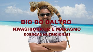 KWASHIORKOR E MARASMO  CASOS DE DESNUTRIÇÃO [upl. by Kirbie]