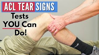 Top 3 Signs You Have an ACL tear Tests You Can Do At Home [upl. by Annie]