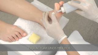 Cómo eliminar los callos de los pies  Tips para pedicuría [upl. by Rinum464]