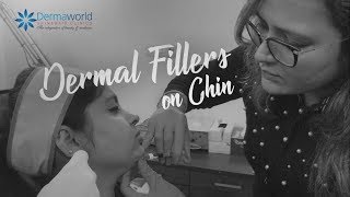 How to get slimmer looking face with minimum pain  NO Surgery  Dermal Filler In West Delhi [upl. by Trovillion]