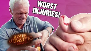 The WORST Injuries Part 1  COMPILATION  River Monsters [upl. by Giliane956]