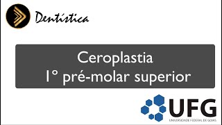 Ceroplastia 1º Pré molar superior [upl. by Sikko]