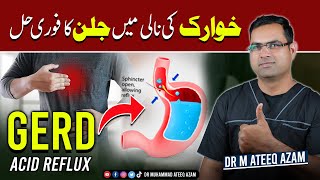 1 Best way to treat Acid Reflux disease GERD [upl. by Boru]